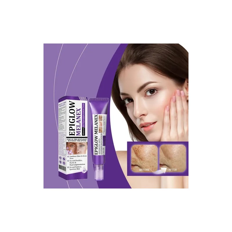 Crema Avanzada De Resistencia A La Hiperpigmentación Para Hi