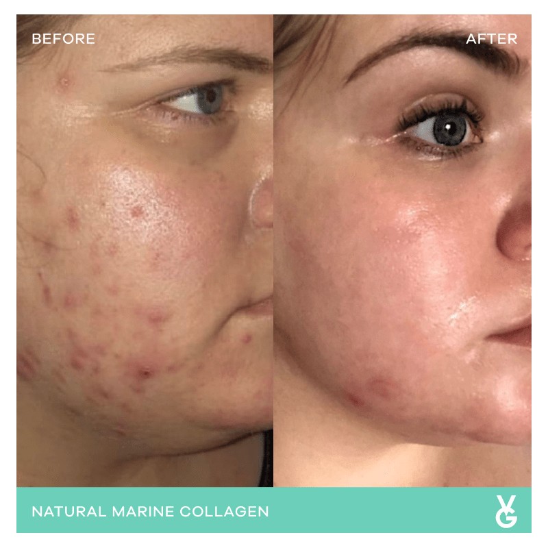 Vida Glow Marine Collagen Original - 30 x 3g Sachets