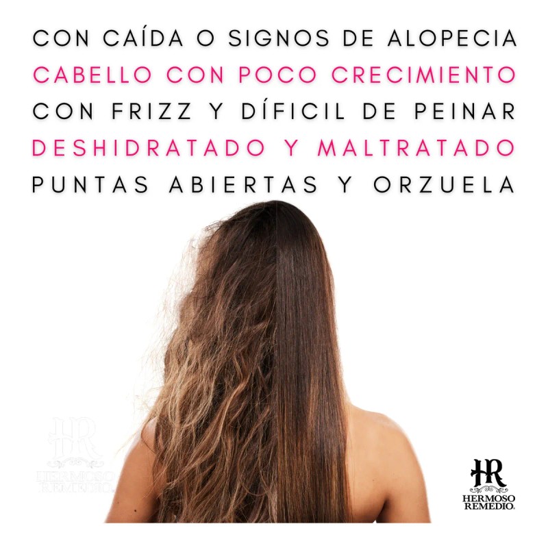 2 Shampoo Anticaida Crecimiento Acelerado Hidratante 7 En 1