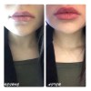 Suero Labios Voluminizador Lipgloss Hidratación Colágeno