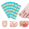 Toenail Patch, Toenail Correction Patch, Ingrown Toenails Correction Patch, Ingrown
