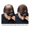 Sevich Peine Optimizador De Linea De Cabello Fibra Capilar