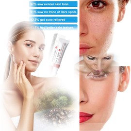 Generic Crema para Manchas Oscuras en La Cara, Dark Spot Remover for Face, Freckles Melasma Brown Spot Corrector for Men Women, Crema para Las Manchas de La Cara 20G