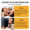 5X Batana Oil Serum Hair Growth For Healthier Thicker&Stronger Fuller