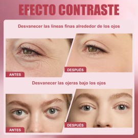 Crema De Ojos Con Retinol Antiedad Y Reduce Ojeras 5g