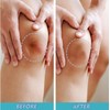 Rayyl Silicone Scar Sheets (1.6" x 60" Roll - 1.5M)