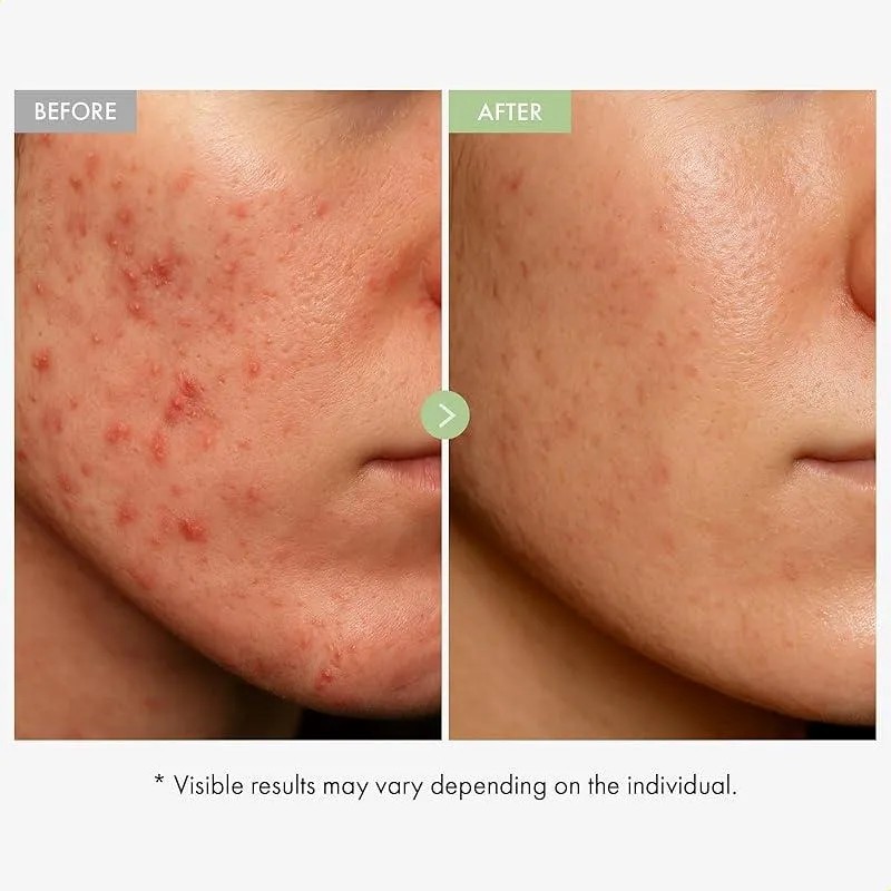 Cuidado Corporal | MercadoLibre.com.mx