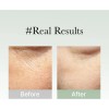 Suero De Máscara Facial Coreano Antienvejecimiento, Arencia