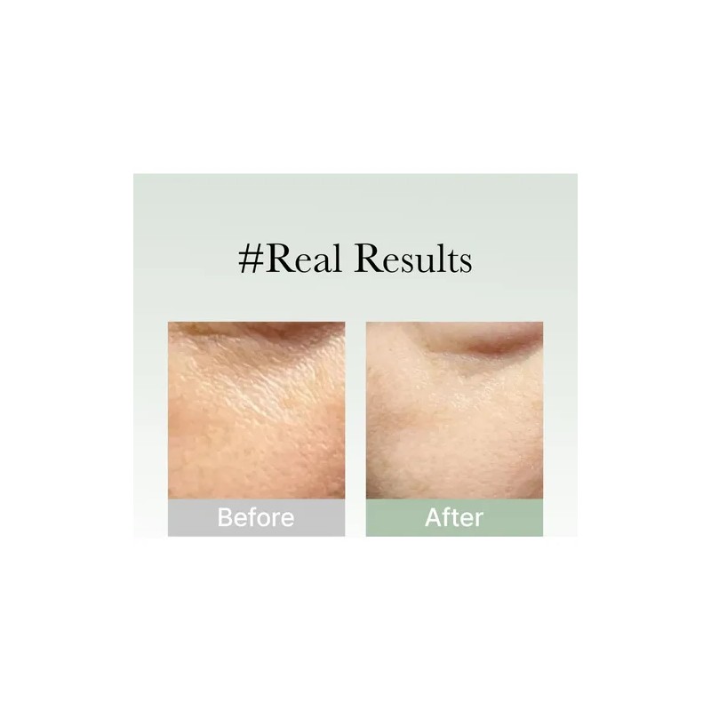 Suero De Máscara Facial Coreano Antienvejecimiento, Arencia