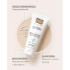 Martiderm Dsp ? ?reas Corporales Espec?ficas