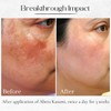 ABERA Kasumi Glowing Cream, Melasma Treatment with Niacinamide & HA,