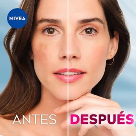Serum 30 ml  Fluido 40 ml Nivea Cellular Luminous 630 Antimanchas 2 pz                                                                                