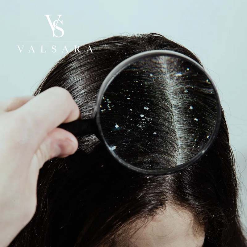 2 Pack Shampoo Alquitran & Creolina (caspa Ceborrea) Champu