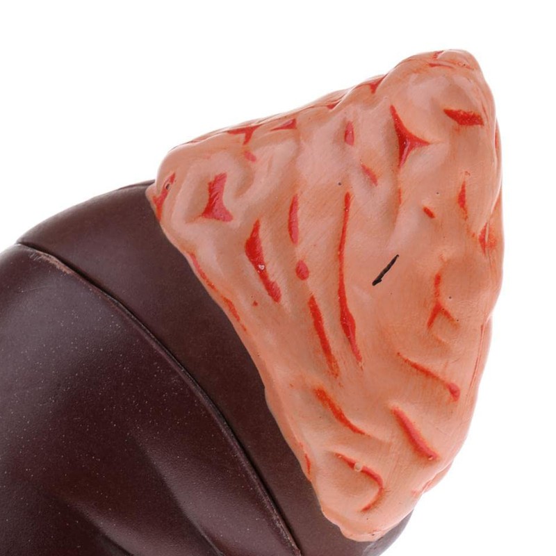 Kidney Model Anatomy Normal Human Anatomical Teaching Doctors Office Educational