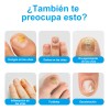 Líquido Antibacteriano De Uñas Grises Para Uñas Enfermas30ml