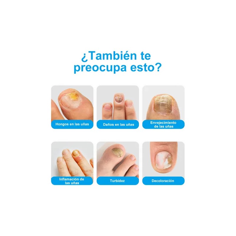 Líquido Antibacteriano De Uñas Grises Para Uñas Enfermas30ml