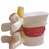 BoNew 1:1.5 Anatomical Human Lumbar Vertebrae Degenerative Lumbar Human Spine