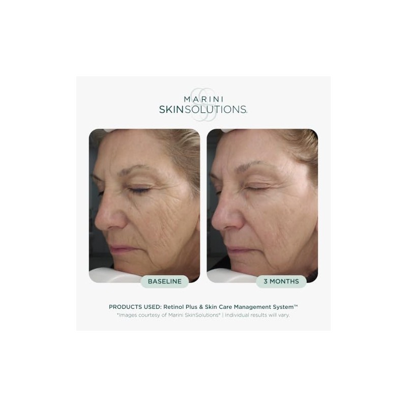 Marini SkinSolutions Retinol Plus - Crema Facial Antiedad con Extracto