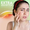 Pimple Patches Korean Skincare: Extra Absorbent 144 Patches Hydrocolloid Dots