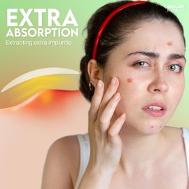 Pimple Patches Korean Skincare: Extra Absorbent 144 Patches Hydrocolloid Dots Spot Stickers for Acne Treatment, , Hydrocolloid technology, Acne Patches for Spot Treatment and Cold Sores