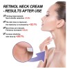 D P Crema De Cuello Eelhoe Retinol Para Arrugas Y