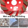 AcbbMNS 2 Pack 4 inch/100mm Diamond Cup Grinding Discs 6