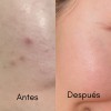 Crema Cebo De Res Hidratante Para Cara Y Cuerpo 100%