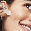 E.l.f. Skin Blemish Breakthrough - Gel Para Combatir El Acné
