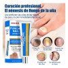 Crema Fúngica Uñas Tolnaftato 1%, Hongos En Uñas Infeccion