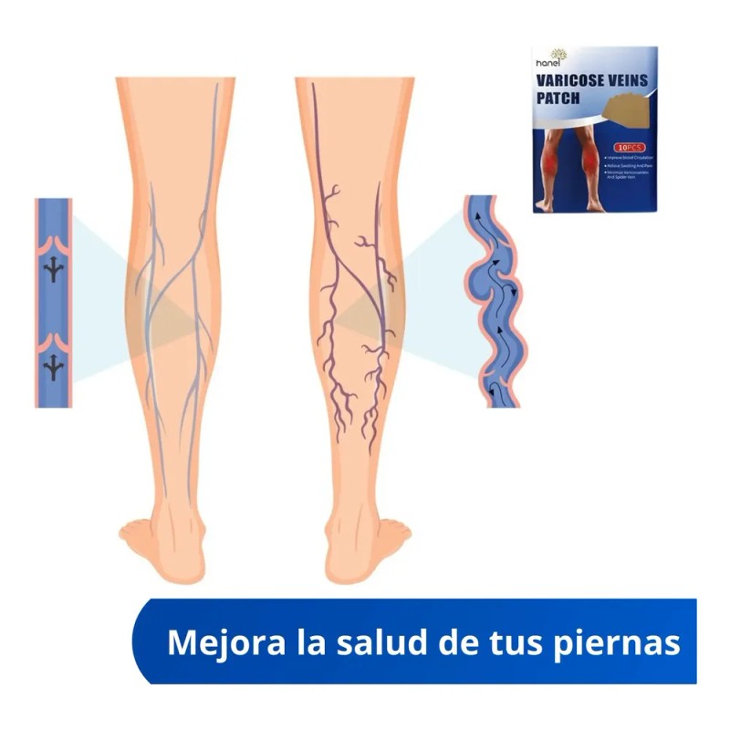 Parches Varices Piernas Alivia Dolor Mejora Apariencia 10 Pz