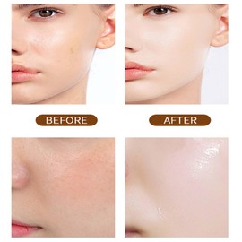 Niacinamide Pure Serum, 2-in-1 Face & Body Niacinamide Serum for Women - Large Capacity Pore Reducer & Balancing Sebum Production - Reduces Enlarged Pores - Highly Effective Skincare Solution-520ml