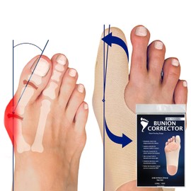 Bunion Bootie Bunion Corrector for Women Big Toe Straightener Ultra-Thin, Discreet, & Corrective Sock for Inside Every Shoe Types. Hallux Valgus Relief for Improved Toe Alignment (Med-Right)