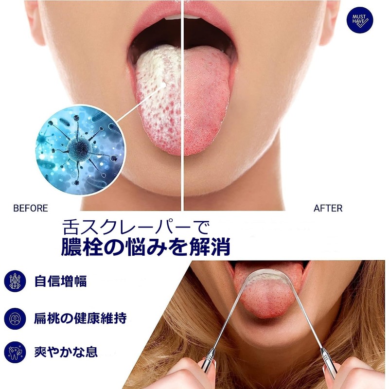ORAVIX Purulent Plug Removal Kit, Tonsils Stinky Balls, For Home