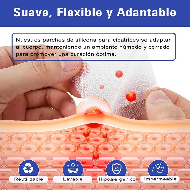 Cinta de Silicona para Cicatrices EWIEIAA de 3 Metros -