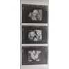Prank 3D Customized Fake Ultrasound Strip of 3 Photos