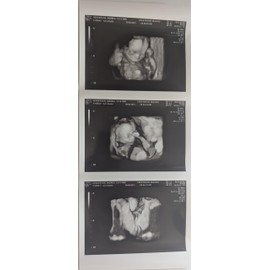 Prank 3D Customized Fake Ultrasound Strip of 3 Photos