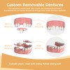 Partial Dentures - Dentures for Missing Teeth & Gaps -
