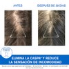 Uriage DS Shampoo Caspa moderada con Piroctona Olamina 200ml -