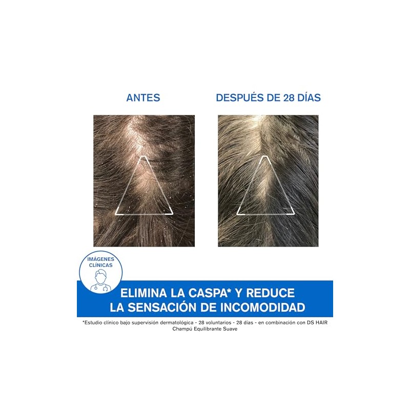 Uriage DS Shampoo Caspa moderada con Piroctona Olamina 200ml -