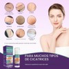 Crema Silicona Cicatrices Gel Tratamiento Avanzado Eliminar Estrías Antiguas Recientes