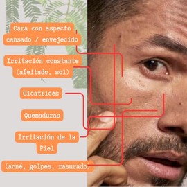 100g Crema de Tepezcohuite  Fórmula Natural para Regeneración Cutánea y Cicatrices  Nutre, Hidrata y Restaura la Piel  Ideal para Marcas, Arrugas y...