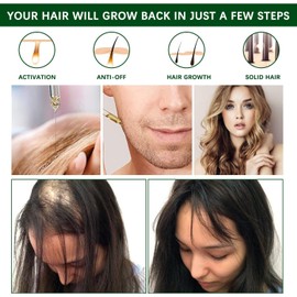 Aceite de Romero para El Cabello,30ml Rosemary Oil for Hair Growth Aceite Esencial de Romero, Reparar el Cabello Seco y Dañado, Estimular el Crecimiento del Cabello y Nutrir el Cabello