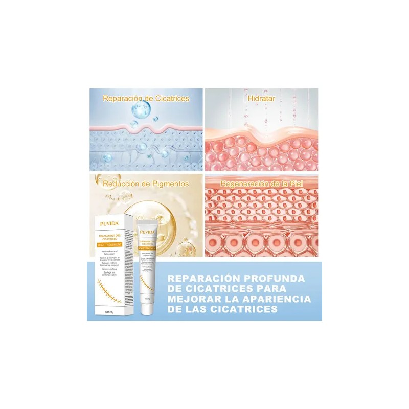 Crema Cicatricial De Minimizar Y Reducir Las Cicatrices 20g