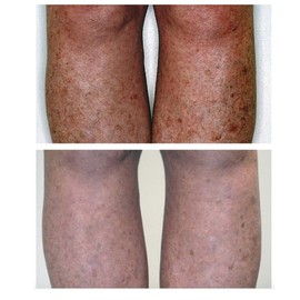 MAYERLING DeAgeing Body Treatment 250ml