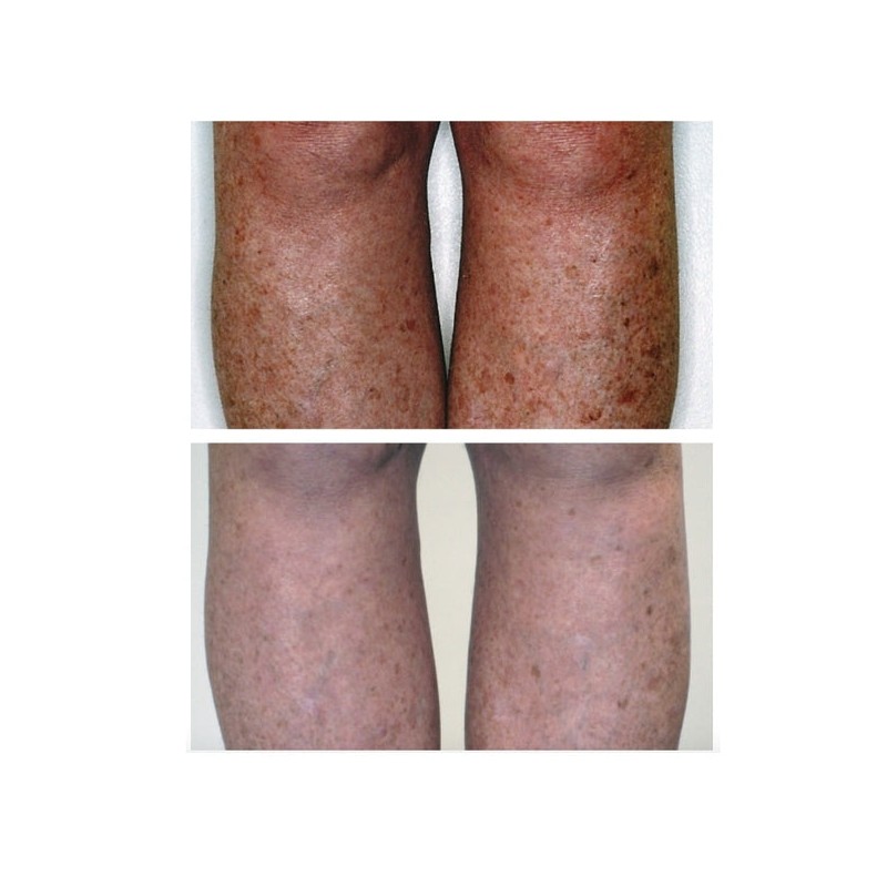 MAYERLING DeAgeing Body Treatment 250ml