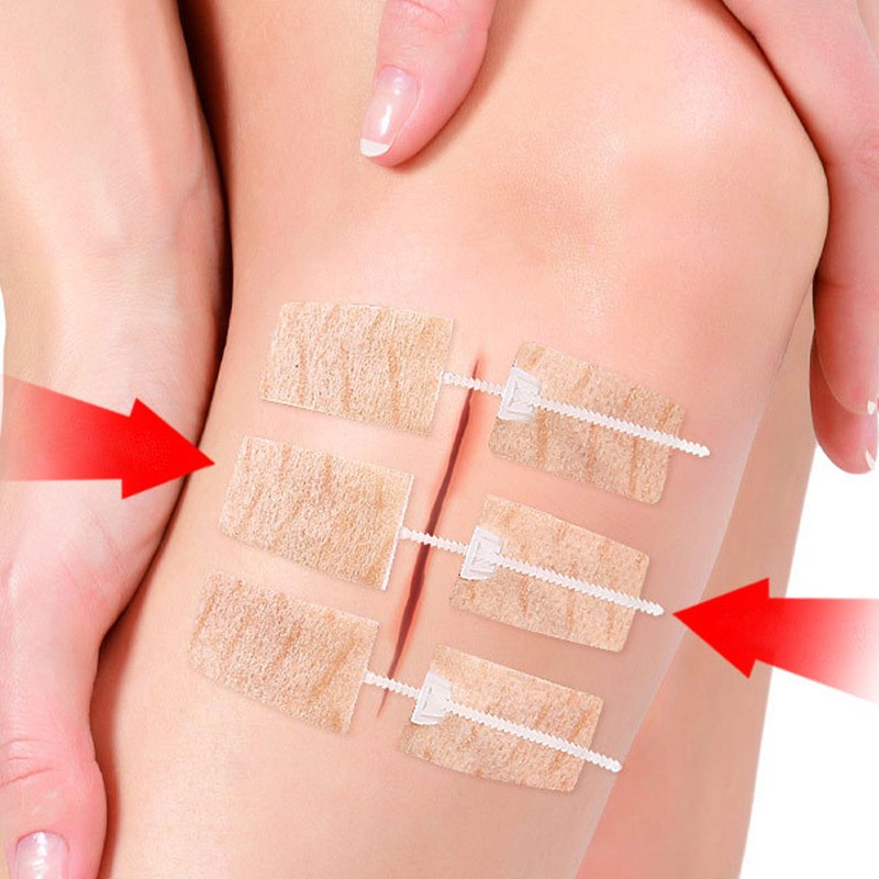 3 Pcs Wound Closure Strip Stitchless Self Adhesive Non Woven