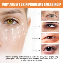 Vitamin C Eye Cream Stick,Under Eyes Cream For Dark Circles And Puffy,Glow Balm, Lift The Skin Around The Eyes & Tighten Eye Bags, Firming Stick For All Skin Types, Women/Men