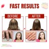 Aurisova Gomitas Cabello Piel Uñas Biotina 6000 Mcg