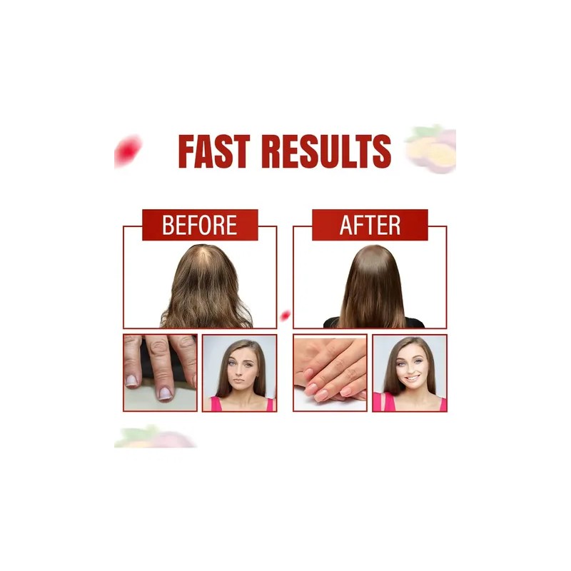 Aurisova Gomitas Cabello Piel Uñas Biotina 6000 Mcg