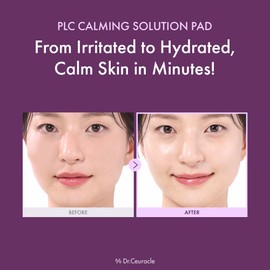 leegeehaam Dr.Ceuracle PLC Calming Solution Pad - Instant Calming and Soothing Toner Pad for Sensitive Skin, Korean Post Laser Skincare (130 Pads)
